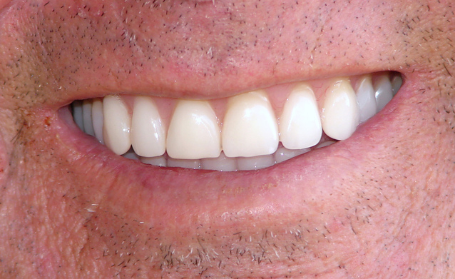 bílé zuby